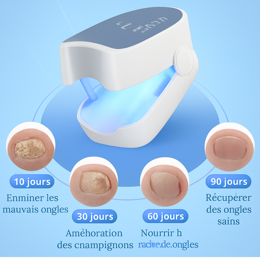OnyClear™ - Appareil Laser Anti-Mycose des Ongles